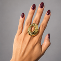 Anillo Zerboni